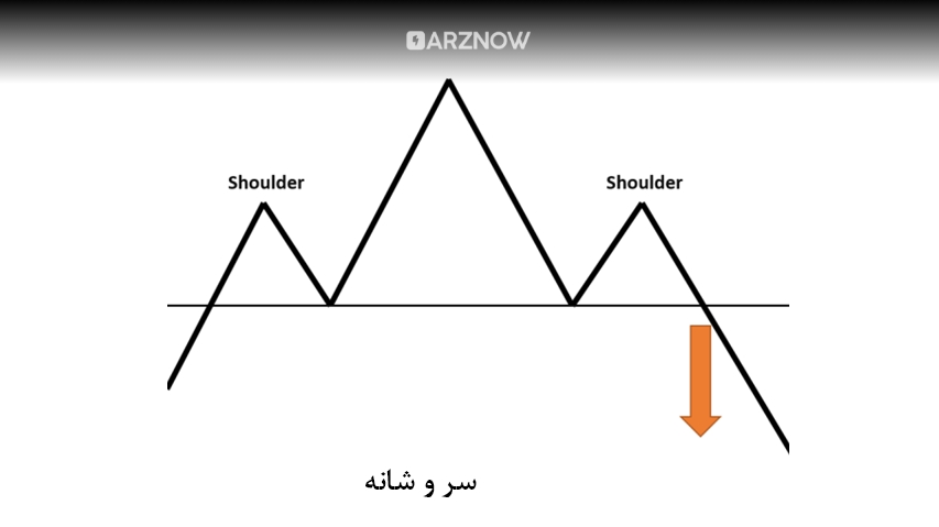 سر و شانه